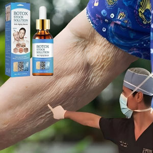 NUEVO SUERO ANTIARRUGAS BOTOX SOLUSION
