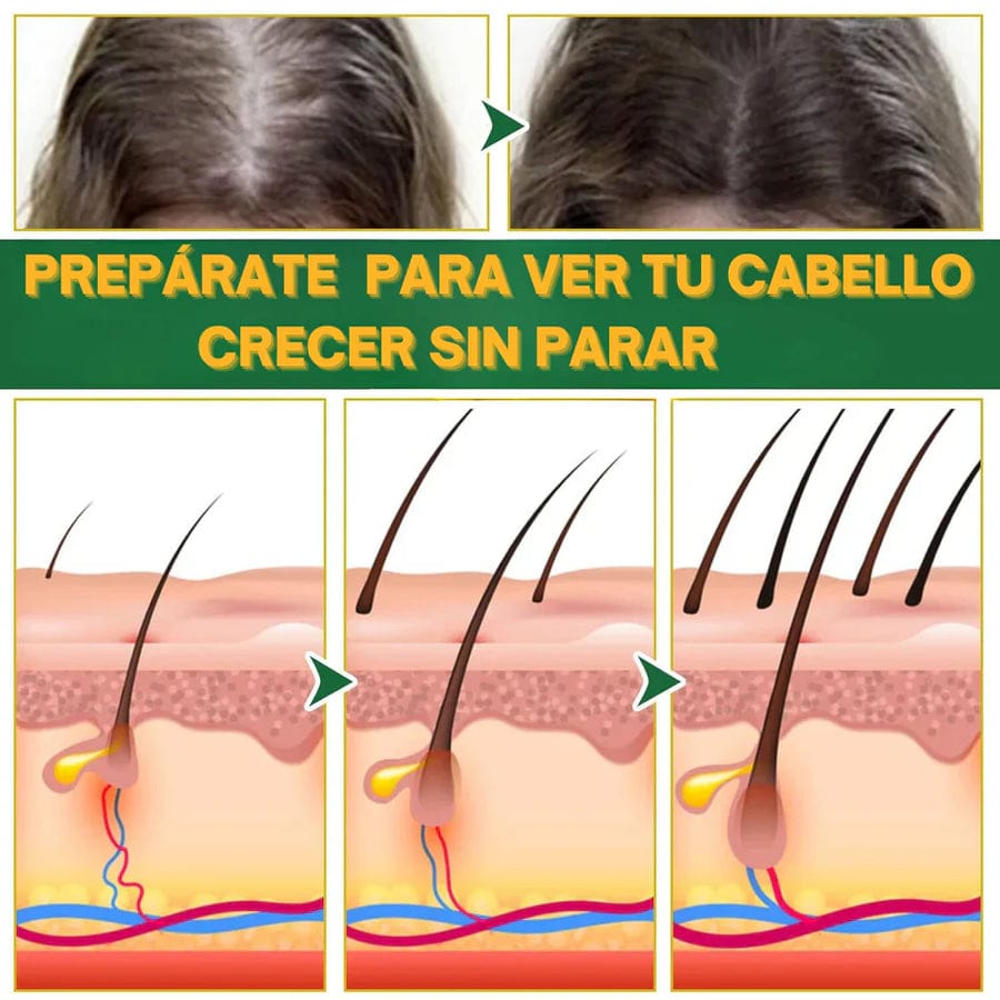 ELIXIR OUHOE - CRECIMIENTO  Y CONTOL DE CAIDAS  CAPILAR