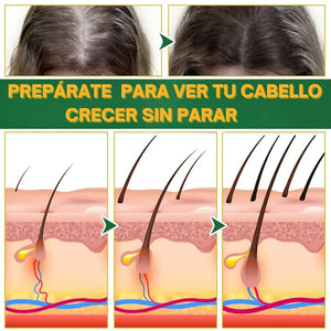 ELIXIR OUHOE - CRECIMIENTO  Y CONTOL DE CAIDAS  CAPILAR